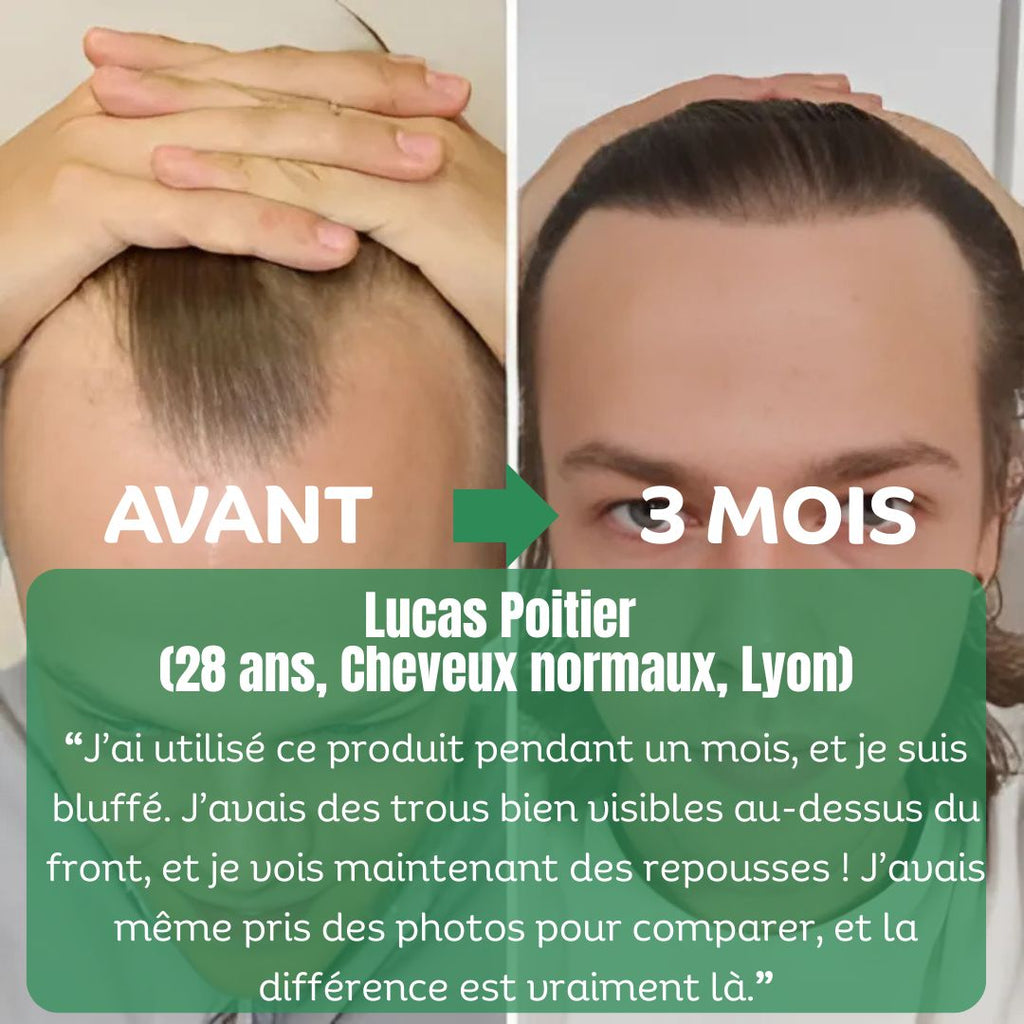 Sérum de Croissance Naturel au Romarin + Kit Bien-Être Offert