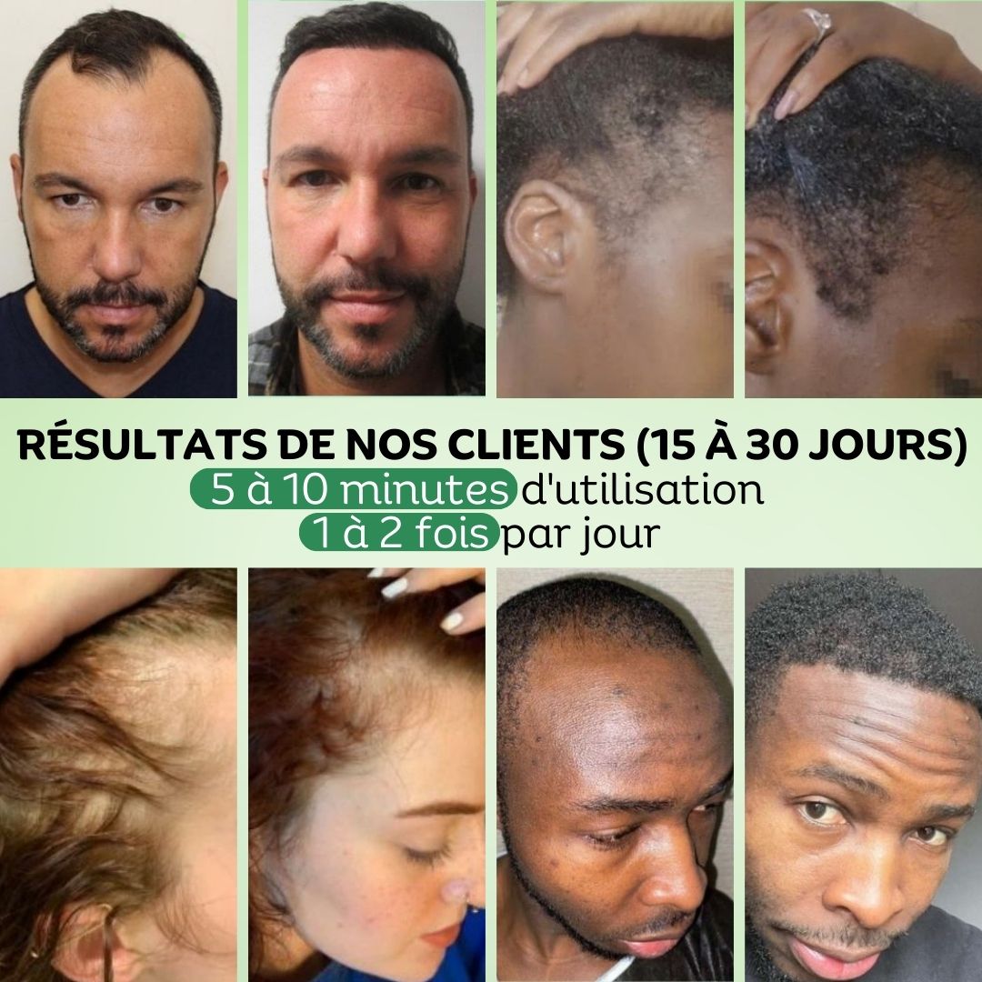 Pack Régulation & Exfoliation Vivaci
